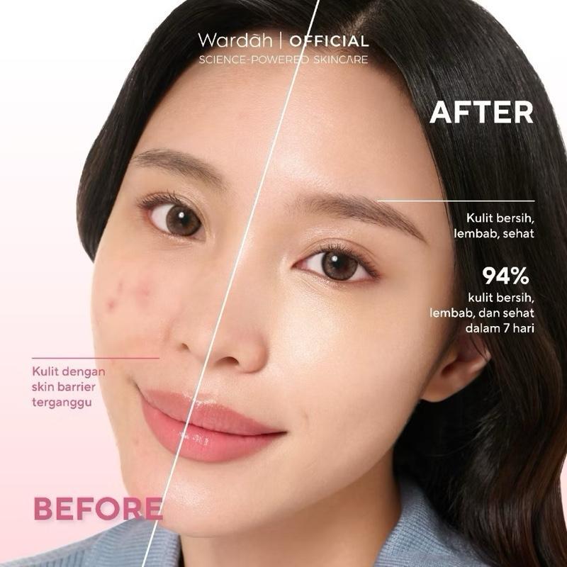 Wardah Hydra Rose Gentle Skin Barrier Cleanser with NMF & Pentavitin – pH 5.5 Hydrating Face Wash