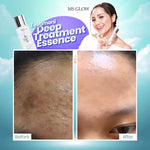Ms glow DEEP TREATMENT ESSENCE