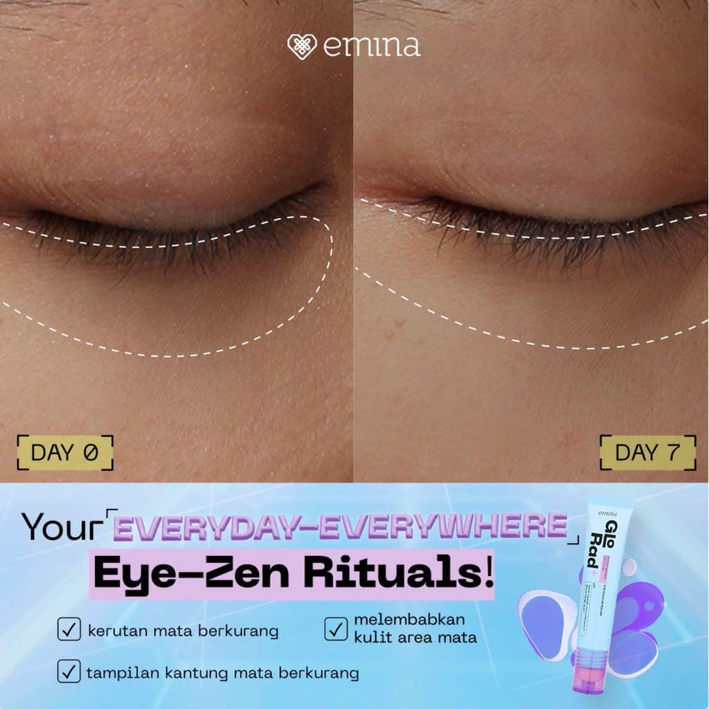 Emina GloRad+ Instant Refresh Puffy Eyes Eye Wake Up Roller Anti Mata Panda Eye Serum with Niacin-Peptide & Derma Niosome-7 for Dark Circles Reduction