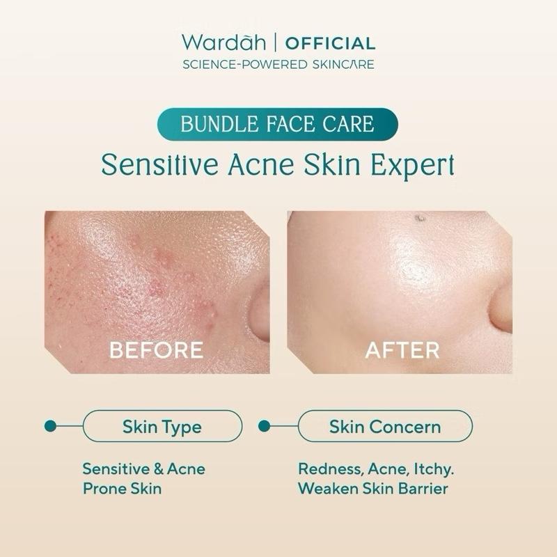 Wardah Beauty Mom’s Glow Kit – Complete Skincare Set for Dry & Sensitive Skin, Dark Spots & Dullness