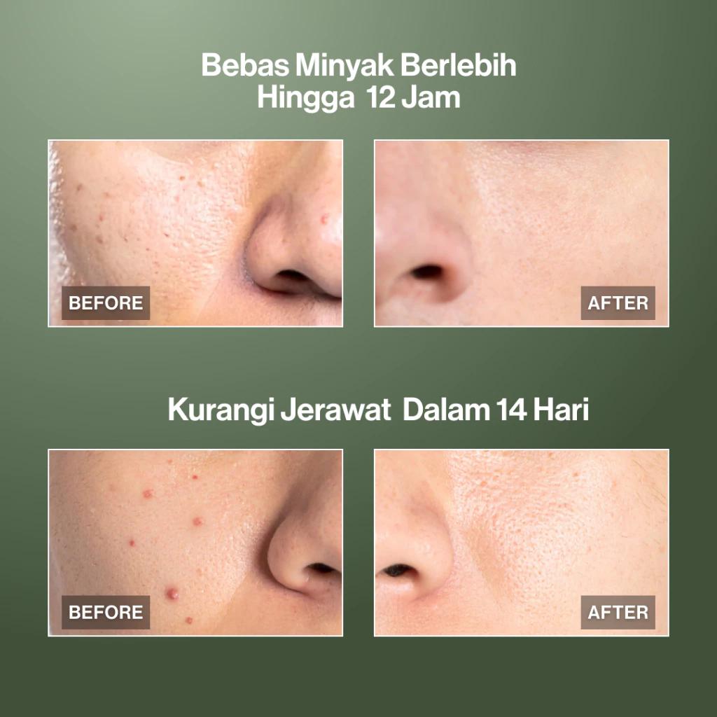 For Men: Kahf Oil & Acne Control Face Wash