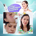 Ms glow DEEP TREATMENT ESSENCE