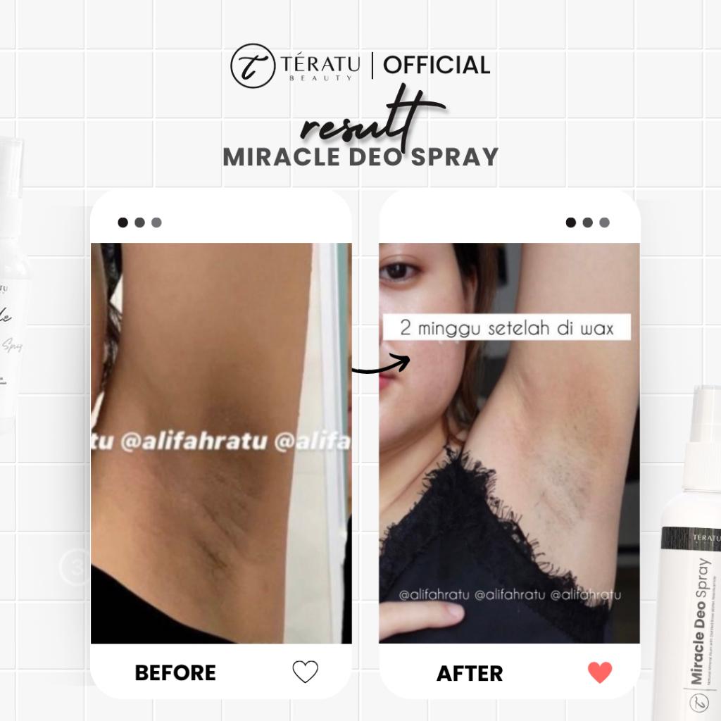 TERATU BEAUTY (Spray) Miracle Deo Spray Deodorant (BPOM Certified)