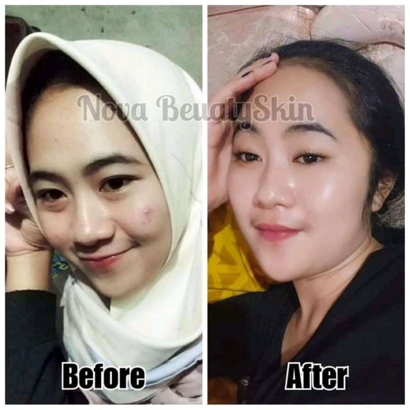 Lesta Beautyskin Daily Glow Krim Cerah Dan Lindungi