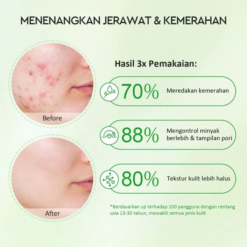 Glad2Glow Mugwort Acne Clay Stick 25g Detox Clear Pores with Mugwort & Salicylic Acid for Skin Care