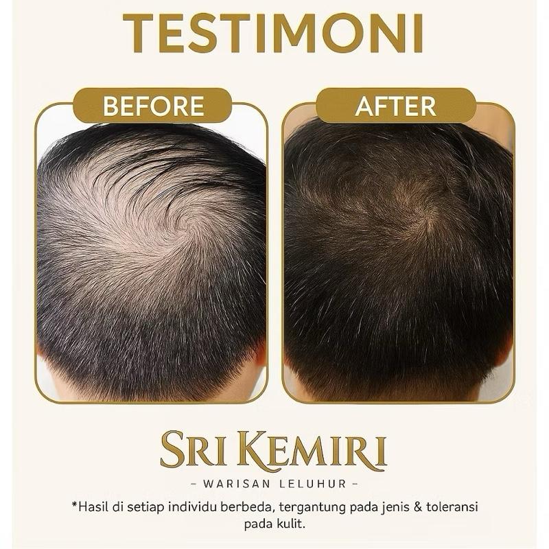 Sri Kemiri Authentic Bali Burned Candlenut Oil | Hair Growth & Beard Booster Elixir – 100% Original & BPOM Certified