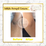 Noera Skin Lightening Cream | Brightening Armpit Cream Pemutih Lipatan Pemutih Ketiak Pemutih Selangkangan