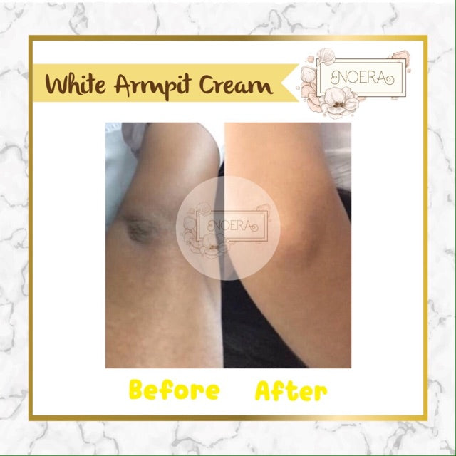 Noera Skin Lightening Cream | Brightening Armpit Cream Pemutih Lipatan Pemutih Ketiak Pemutih Selangkangan