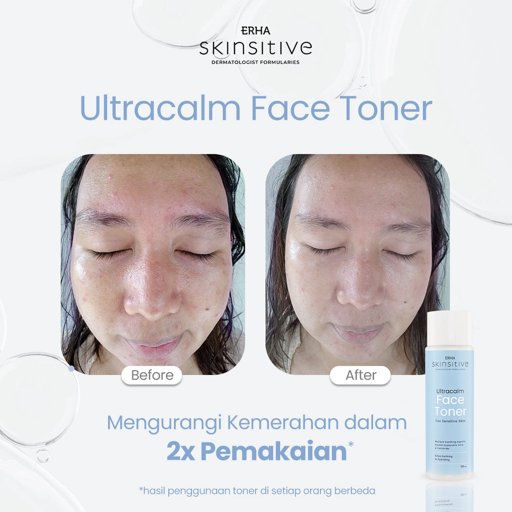 ERHA Skinsitive Ultracalm Face Toner 100g | Hydrating & Calming Toner untuk Semua Jenis Kulit (Normal - Sensitif) | Menenangkan Kulit Kering, Kemerahan, Iritasi | Skin Barrier Lebih Kuat dengan Ceramide, Niacinamide, 7 Calming Agents