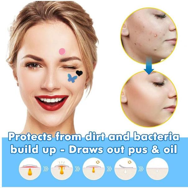 Acne Pimple Patch Penutup Jerawat 36PCS / STARS 28PCS / PURPLE 24PCS