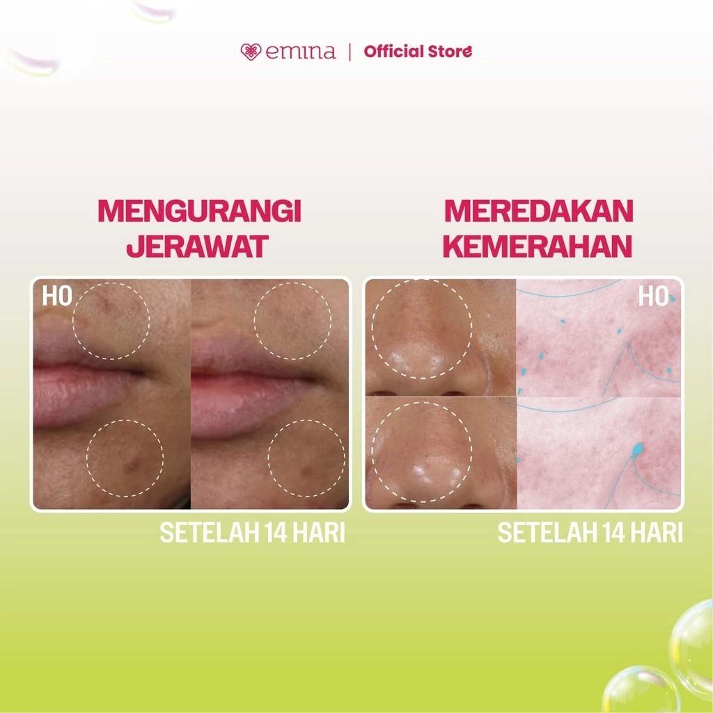 Emina Prebiotic Tranexamic Acid Brightening Face Wash for Acne Prone Skin 50ml 100ml | Sabun Muka Kulit Berjerawat dan Sensitif
