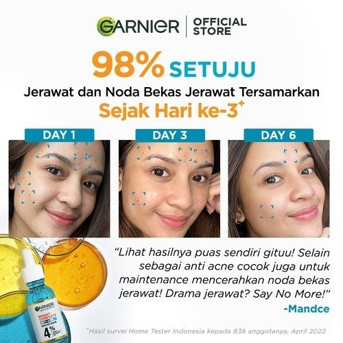 Garnier Bright Complete Anti Acne Starter Kit Serum 15 ml + Foam 100 ml - Skincare Jerawat Vitamin C