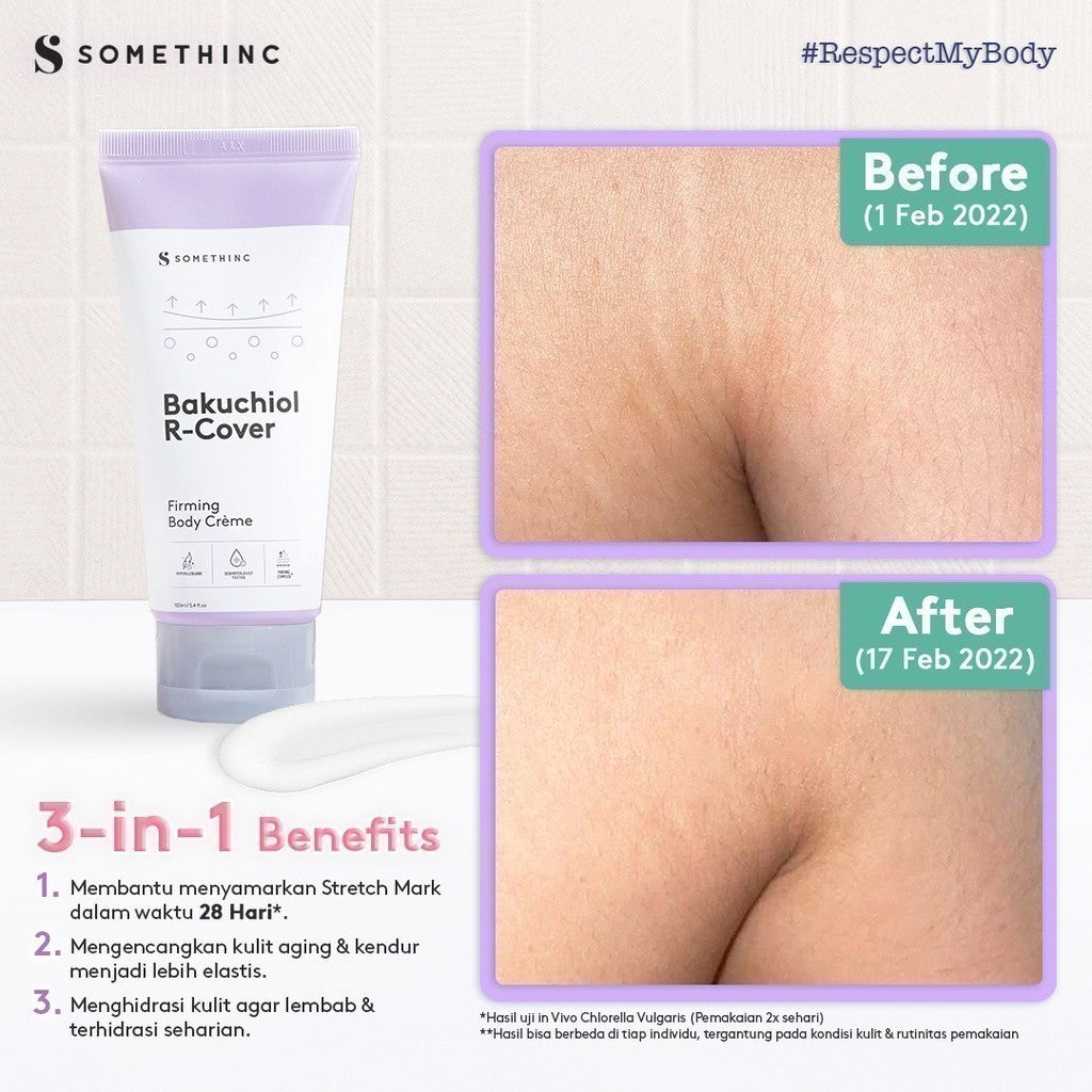 SOMETHINC Bakuchiol R-Cover Firming Body Crème - Krim Menyamarkan Strech Mark