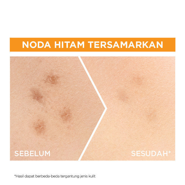 Paket Skincare Garnier Bright Complete Dark Spot Set (Micellar Vitamin C 125ml, Serum 30ml, Gel Moisturizer 50ml) - Untuk mencerahkan kulit kusam dan mengurangi flek hitam