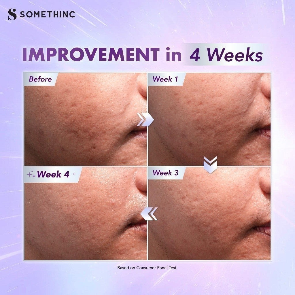 SOMETHINC BioSpicule Renewal Serum