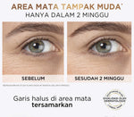 BARU! L'Oreal Paris Triple Roller 2.5% Hyaluron + Caffein Eye Serum Skincare - 20ml (Eye Serum dengan Instant Cooling Effect untuk menyamarkan garis halus dalam 2 minggu)