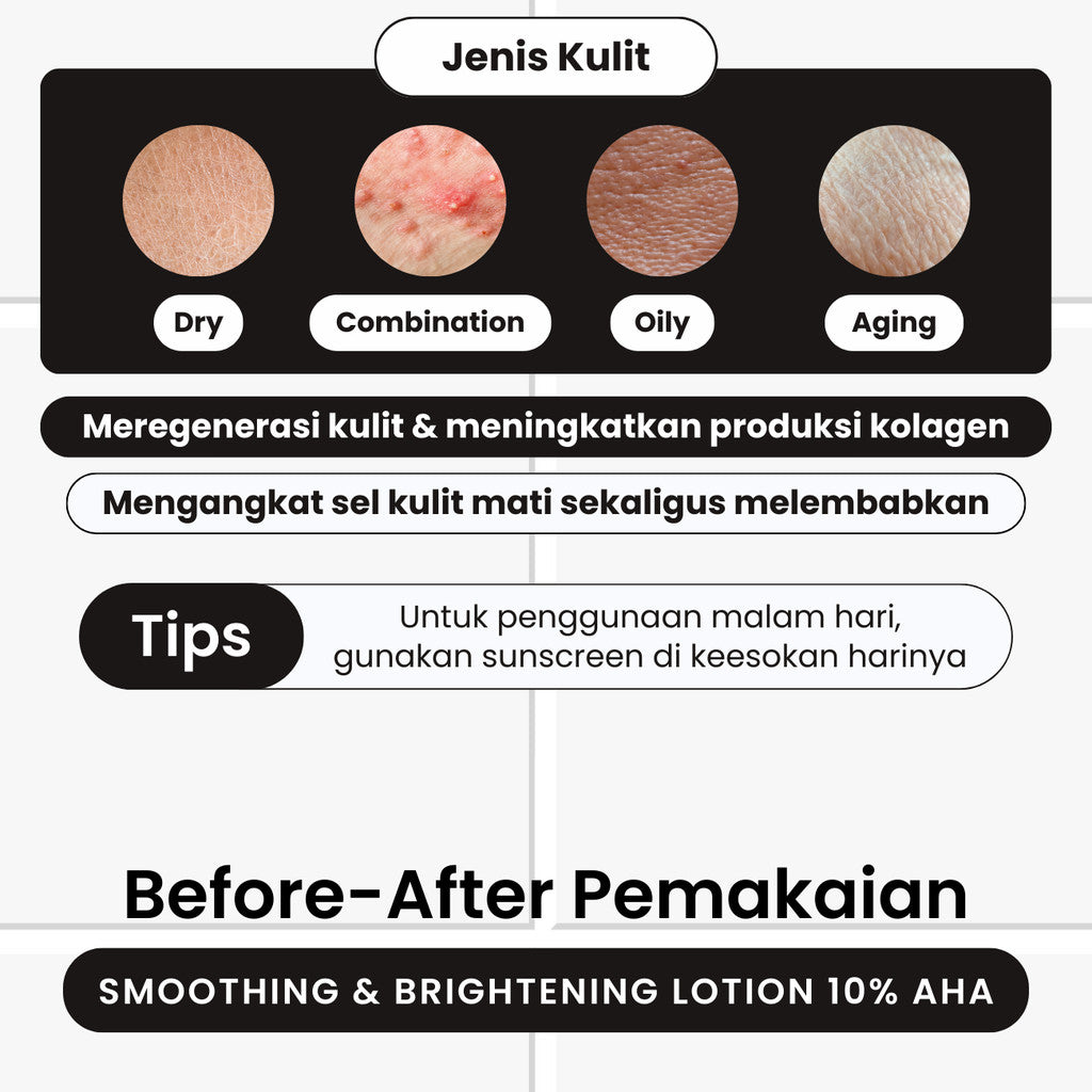 [HOT PRODUCT] TERATU BEAUTY Smoothing & Brightening Lotion AHA 10% Glycolic Acid (Mencerahkan & Menghaluskan Kulit)