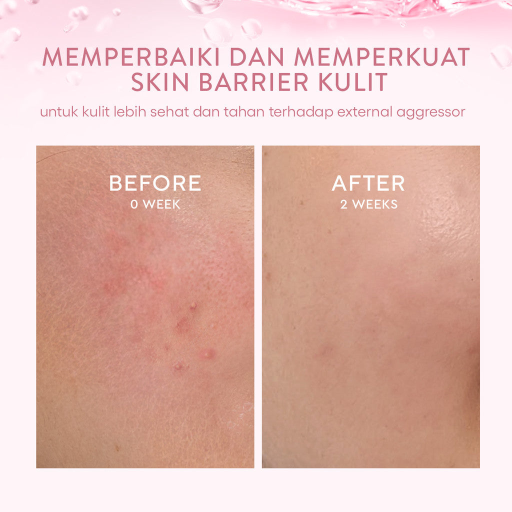 WARDAH Hydra Rose 14X Hyaluronic Pentavitin Deep Barrier Repair Serum 30 ml - Serum dengan Allantoin - Perawatan Wajah untuk Kulit - Resilient Skin - Skincare