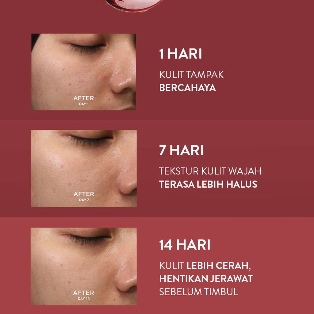 Wardah Exfo Peeling Serum 5% Glycolic Acid 3% Maltobionic Acid 2% Succinic Acid Micro - Serum Exfoliasi Wajah, Serum Membantu Mencerahkan dan Menghaluskan Wajah - Skincare