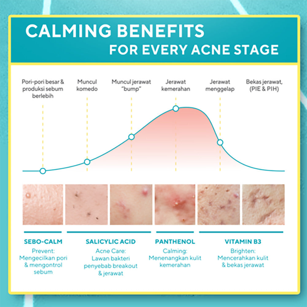 WARDAH Twin pack UV Shield Acne Calming Sunscreen 2 pcs - Skincare