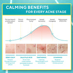 WARDAH Twin pack UV Shield Acne Calming Sunscreen 2 pcs - Skincare