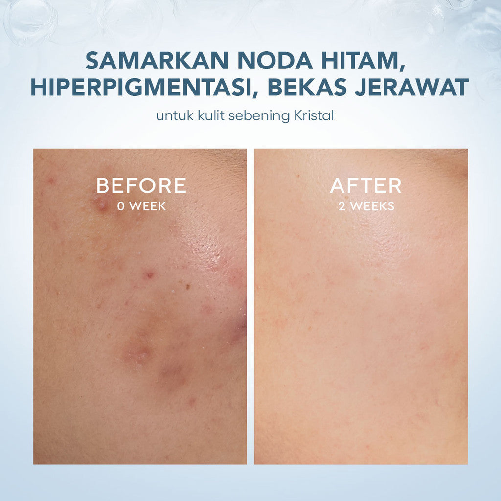 Wardah 3% Tranexamic Acid + Alpha Arbutin Crystal Secret Dark Spot Brightening Serum 20 ml - Serum Dengan Ekstrak Edelweiss Mencerahkan dan Menyamarkan Flek Hitam untuk Semua Jenis Kulit- Skincare