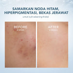 Wardah 3% Tranexamic Acid + Alpha Arbutin Crystal Secret Dark Spot Brightening Serum 20 ml - Serum Dengan Ekstrak Edelweiss Mencerahkan dan Menyamarkan Flek Hitam untuk Semua Jenis Kulit- Skincare