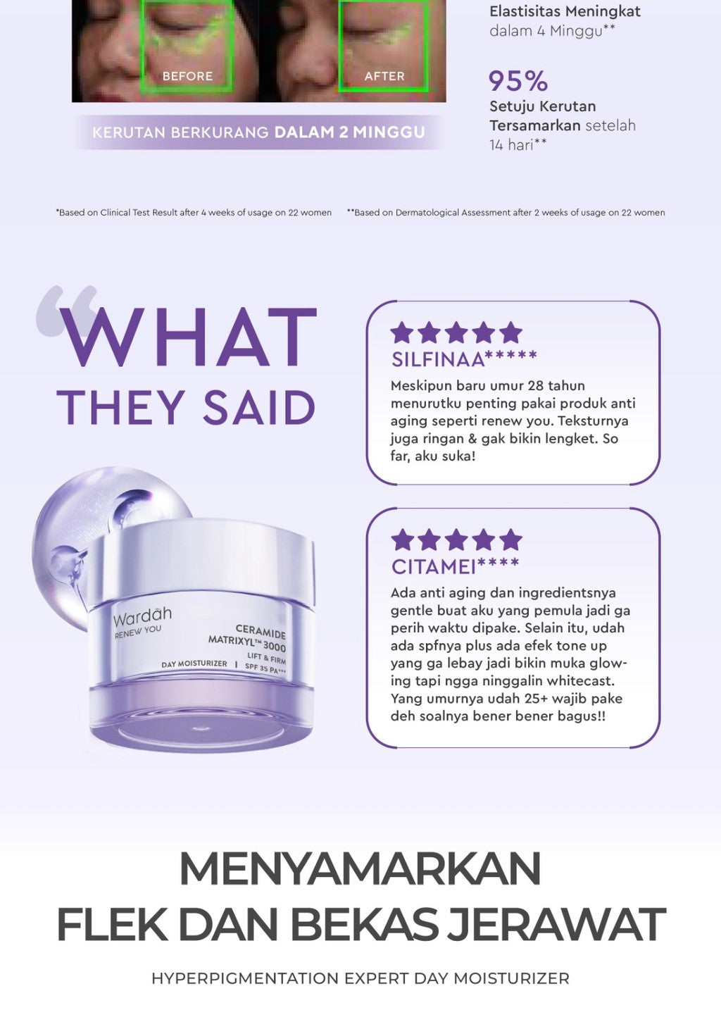 WARDAH Crystal Secret a-Arbutin 5% Niacinamide Hyperpigmentation Expert SPF 35 PA+++ Day Moisturizer 30 g - Skincare