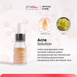 JGLOW Acne Sulfur 10ml – Keringkan Jerawat Aktif & Redakan Meradang | Skincare Anti-Jerawat BPOM