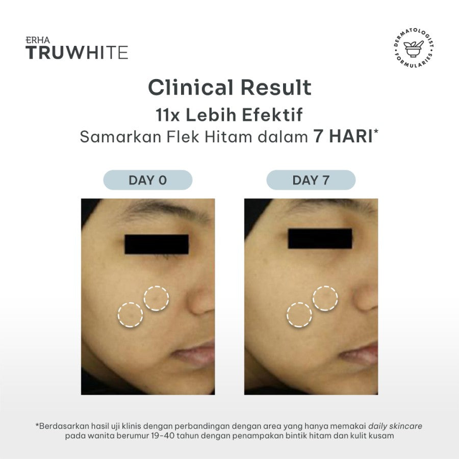 ERHA Truwhite Niacinamide & Peptide Dark Spot Corrector 15g - Krim Pencerah Flek Hitam