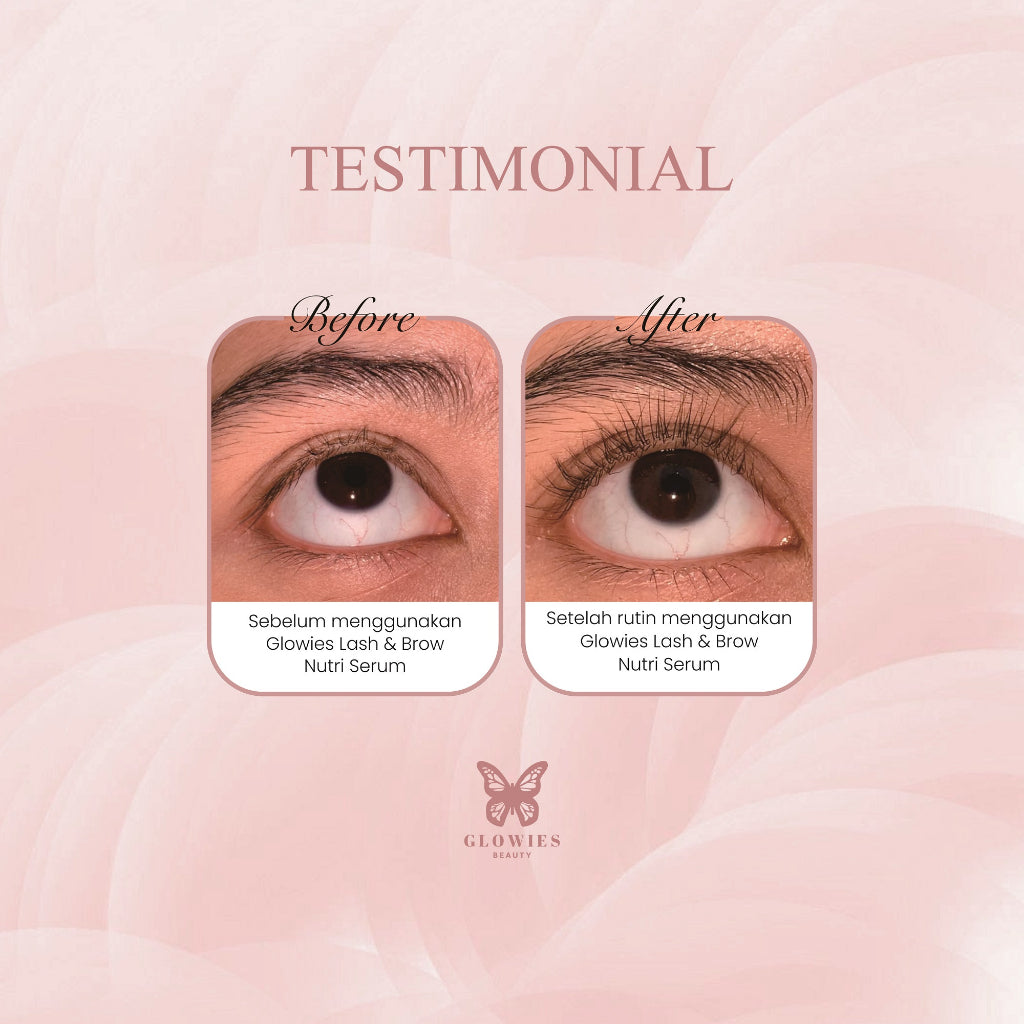 Glowies Serum Bulu Mata Serum Bulu Mata dan Alis Eyelash & Brow Nutri Serum Menguatkan Menumbuhkan bulu Mata dan Alis 4 ml Water Based Serum