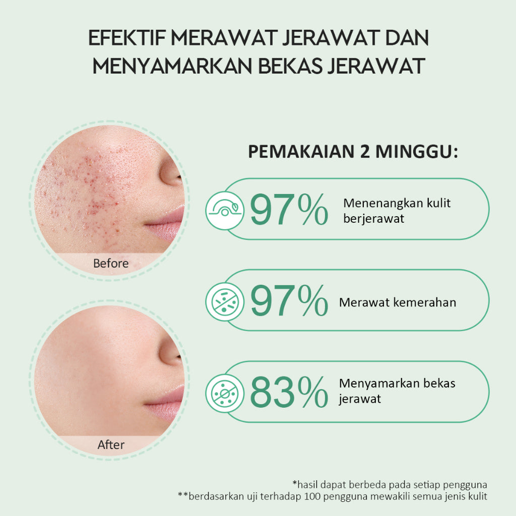 Glad2Glow Salicylic Acid Overnight Acne Spot Cream Treatment with Centella | Obat Jerawat Salep Jerawat Acne Gel Anti Acne Cream penghilang bekas jerawat g2glow acne patch jerawat obat totol jerawat G2G official store