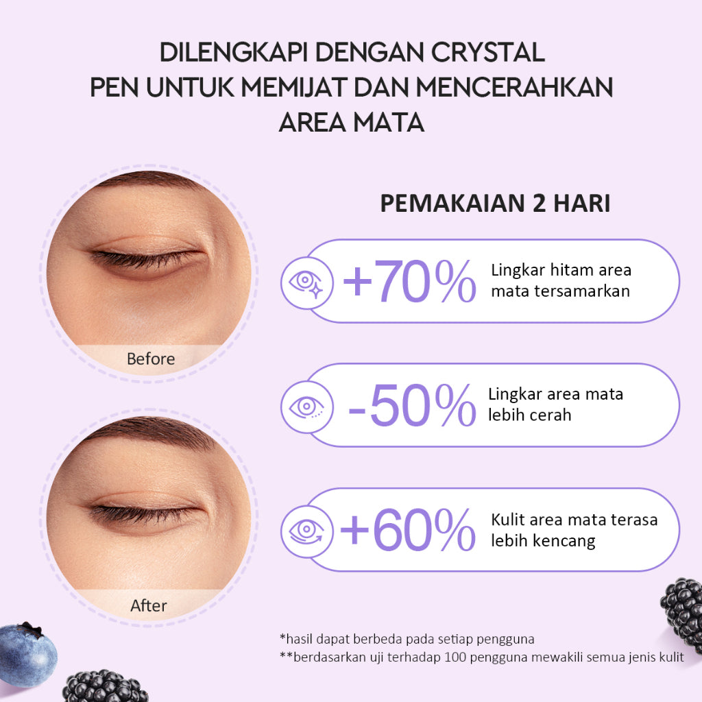 Glad2Glow Berry Eye Cream Brightening Eye Serum | Krim Mata with Electronic Massager with Peptide mata panda  kantung mata untuk Mengurangi Kantung Mata Eye Cream Eye Serum Penghilang Mata Panda Kantung Mata Cream Treatment g2glow official store