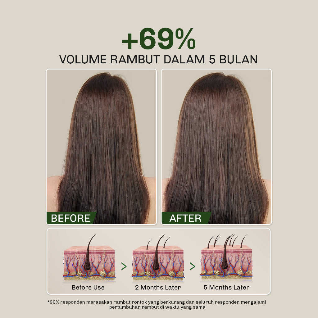 [BUNDLE] Lavojoy Hold Me Tight Pro Shampoo + Conditioner Spring Wonder | Hair Treatment | Perawatan Intensif untuk Rambut Rontok | Perawatan Rambut | Ceramide | Salicylic Acid | Hair Care | Citric Acid