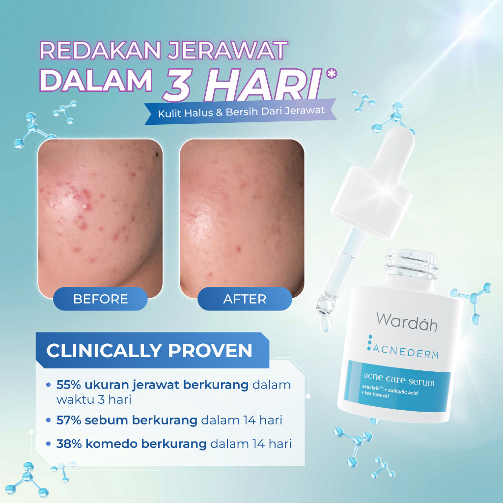 WARDAH 5% Azeclair + Salicylic Acid Acnederm Acne Care Serum 15 ml - Serum dengan Tea Tree Oil - Serum Jerawat dan Mencerahkan Kulit - Menyamarkan Noda Bekas, Mengurangi Minyak Berlebih - Skincare
