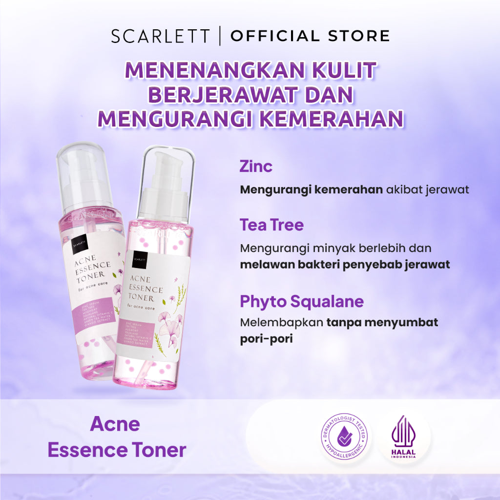 Scarlett Whitening Acne Essence Toner - Toner Ringan Wajah Penghilang & Perawatan Jerawat Ampuh Atasi Hingga Bekasnya with Double Action Salicylic Acid tanpa Bikin Kulit Iritasi