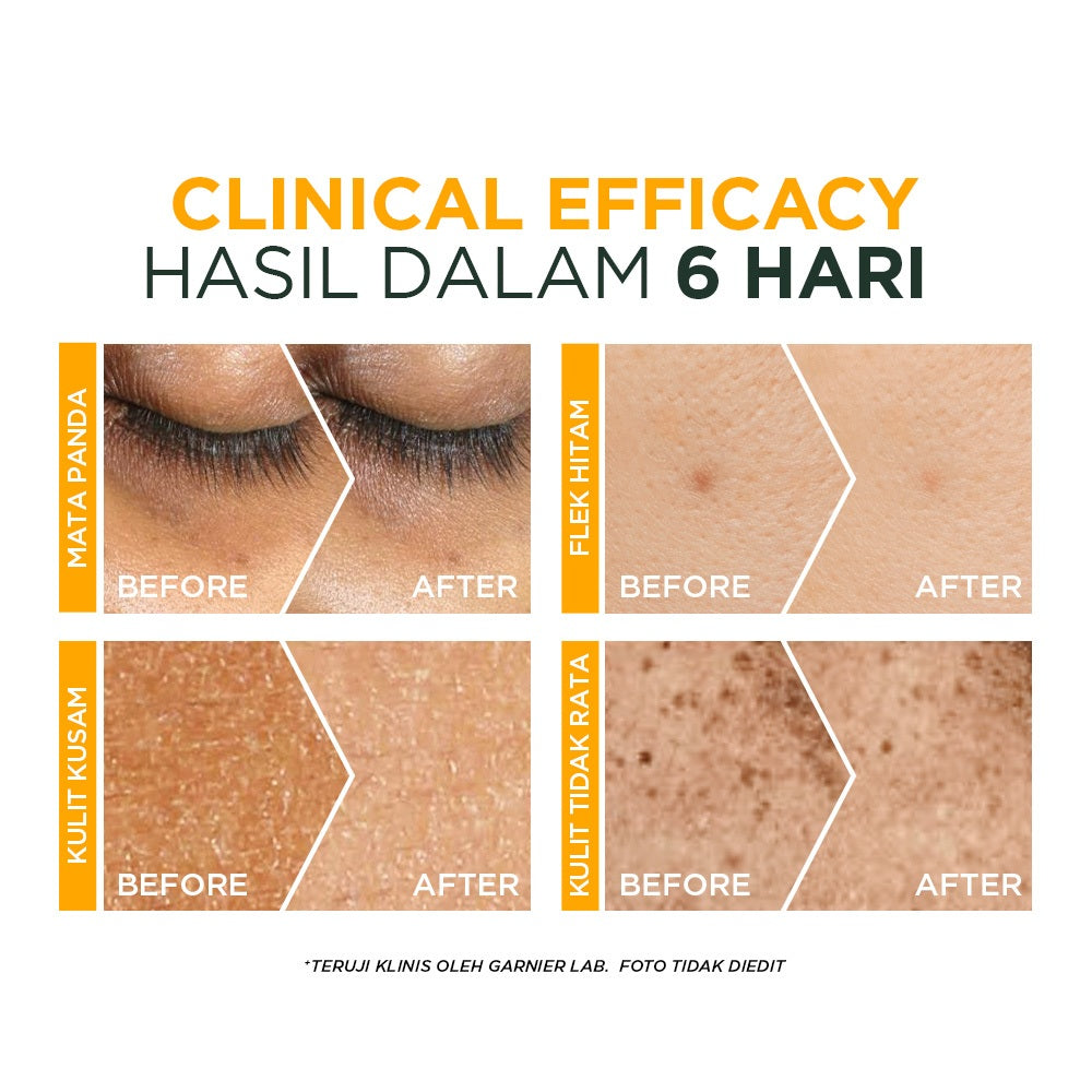 GARNIER Serum Vitamin C Bright Complete Vitamin C Ampoule Serum Skincare - 1.5 ml Serum Mencerahkan Wajah Cepat Cerahkan Noda Hitam Serum Wajah