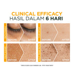 GARNIER Serum Vitamin C Bright Complete Vitamin C Ampoule Serum Skincare - 1.5 ml Serum Mencerahkan Wajah Cepat Cerahkan Noda Hitam Serum Wajah