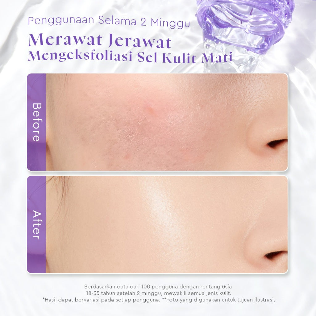 Glad2Glow Daily Exfoliating Toner toner badan face mist hydrating toner centella Toner eksfoliasi wajah glycocid acid glycolic acid kulit halus Eksfoliasi Lembut Jaga kulit Anda tetap terhidrasi Rawat kulitmu Skincare Mikrodermabrasi g2glow official store