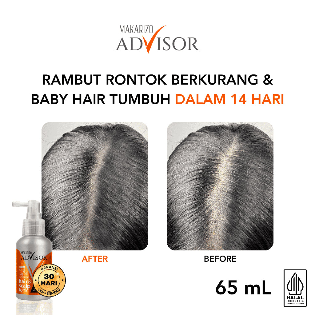 Makarizo Advisor Hair & Scalp Tonic 60 mL & 65 mL - 2 in 1 Untuk Rambut Rontok dan Ketombe