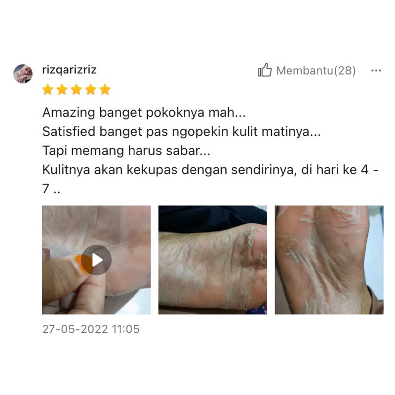 Noera Exfoliating Foot Mask BPOM | Foot Peel - Masker Kaki Pengelupas Kulit Mati - Noeraskincare