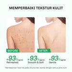 Lavojoy Solve It Now Body Wash | Sabun Mandi Cair Untuk Melembabkan Kulit Sensitif,  Merawat Kulit Berjerawat Dan Menghaluskan Tekstur Kulit Kasar | Mengandung Amino Acid, AHA, BHA Dan Zinc PCA