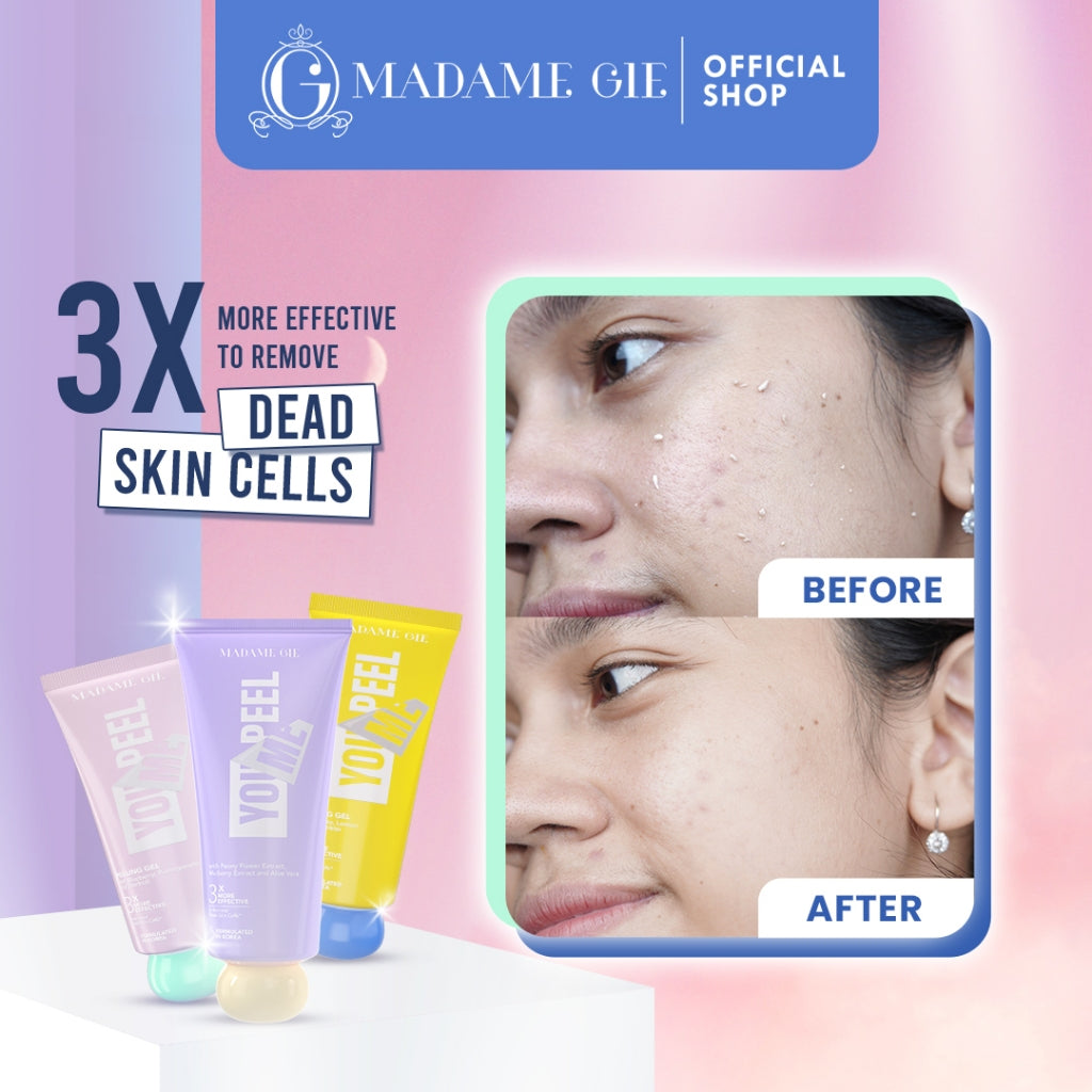 [BELI 2 LEBIH HEMAT]  Madame Gie Madame You Peel Me - Peeling Gel
