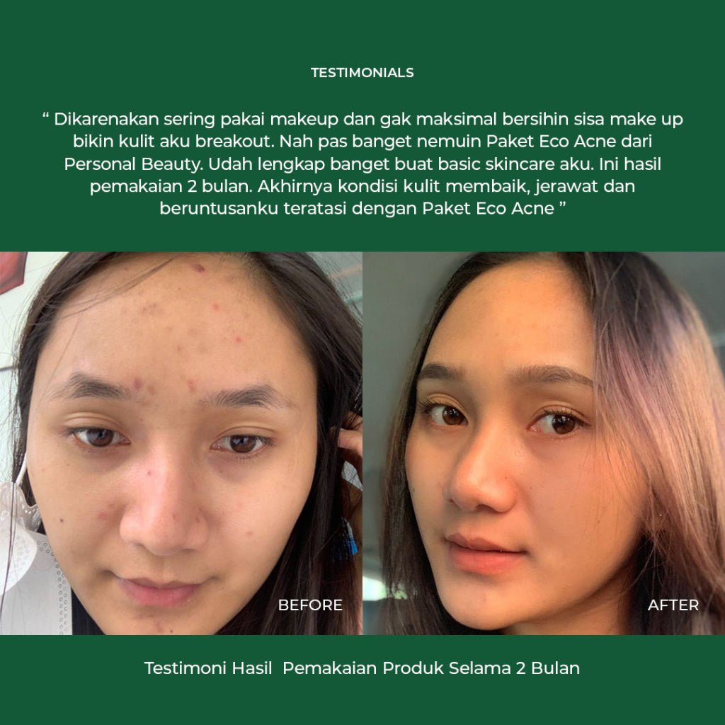 PERSONAL BEAUTY Skincare Set ECO Acne | Perawatan Wajah Berjerawat & Beruntusan - (Tea Tree Oil, Aloe Vera, Niacinamide, Salicylic Acid, Oil Control, Bekas Jerawat)