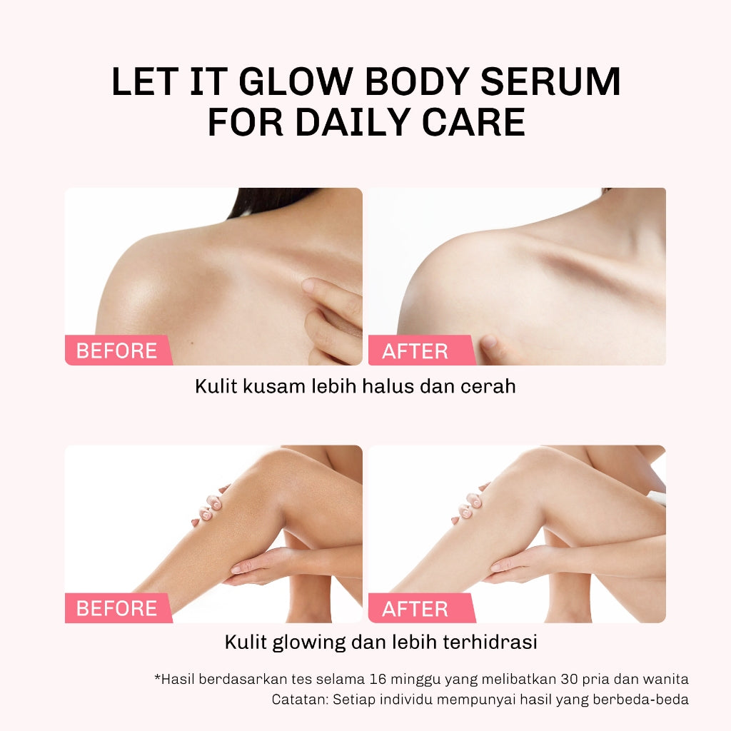 Lavojoy Let It Glow Body Serum Skin Brightening Upgraded Version | Body Serum Untuk Mencerahkan Dan Melembabkan Kulit Dengan Niacinamide + Ceramide + Vitamin E