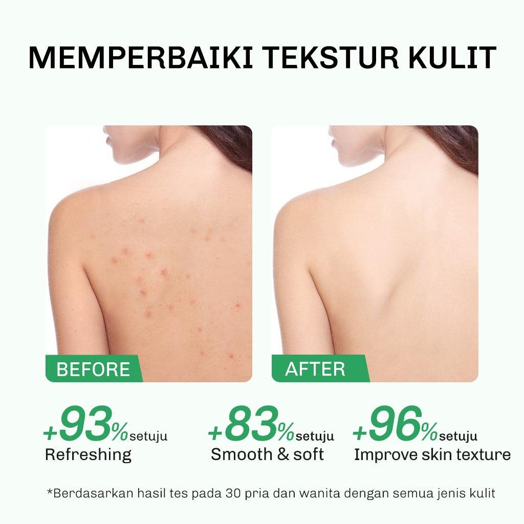 Lavojoy Solve It Now Body Serum | Body Lotion Untuk Melembabkan Kulit Sensitif,  Merawat Kulit Berjerawat, Menghaluskan Tekstur Kulit Kasar Dan Anti Jerawat | Mengandung Amino Acid, AHA, BHA Dan Zinc PCA