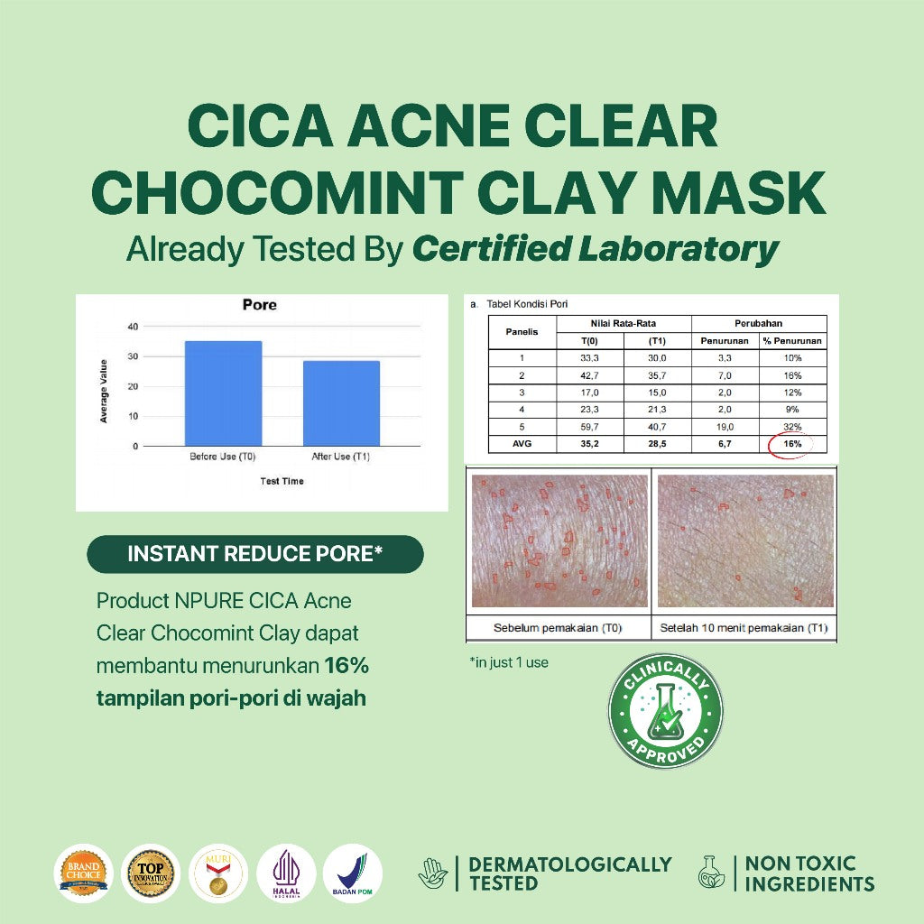 NPURE CENTELLA ASIATICA ACNE CLEAR CHOCOMINT CLAY MASK / Masker Anti Jerawat Komedo / Masker Kulit Berminyak