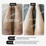 [HOT PRODUCT] TERATU BEAUTY Smoothing & Brightening Lotion AHA 10% Glycolic Acid (Mencerahkan & Menghaluskan Kulit)