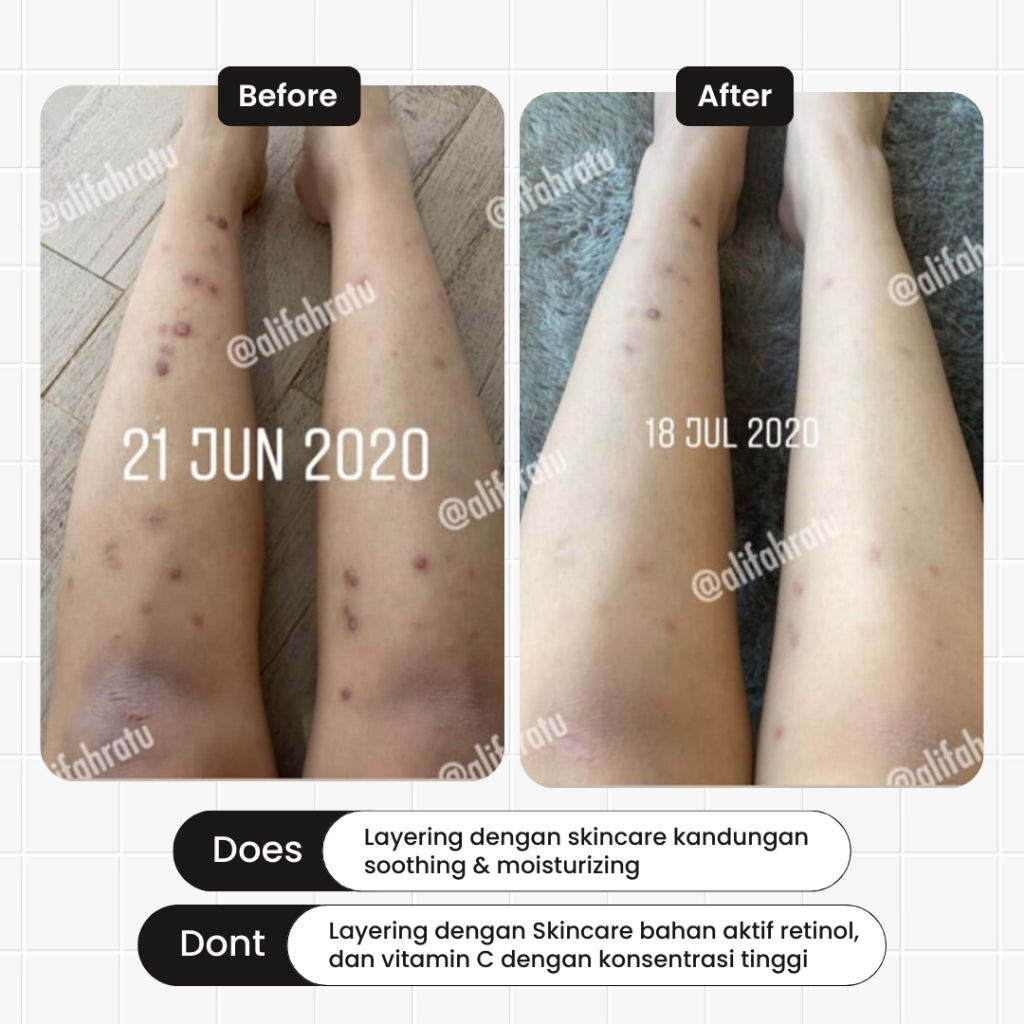[HOT PRODUCT] TERATU BEAUTY Smoothing & Brightening Lotion AHA 10% Glycolic Acid (Mencerahkan & Menghaluskan Kulit)
