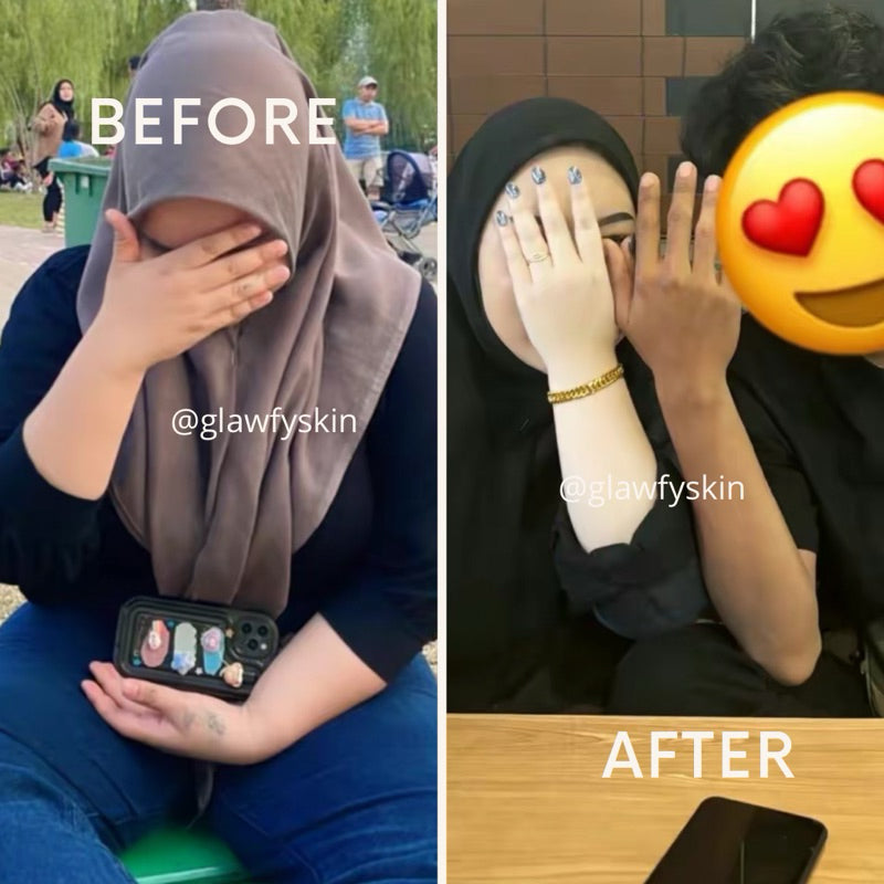 Glawfyskin - Infused Body Serum Booster | Body Serum whitening By Glawfyskin